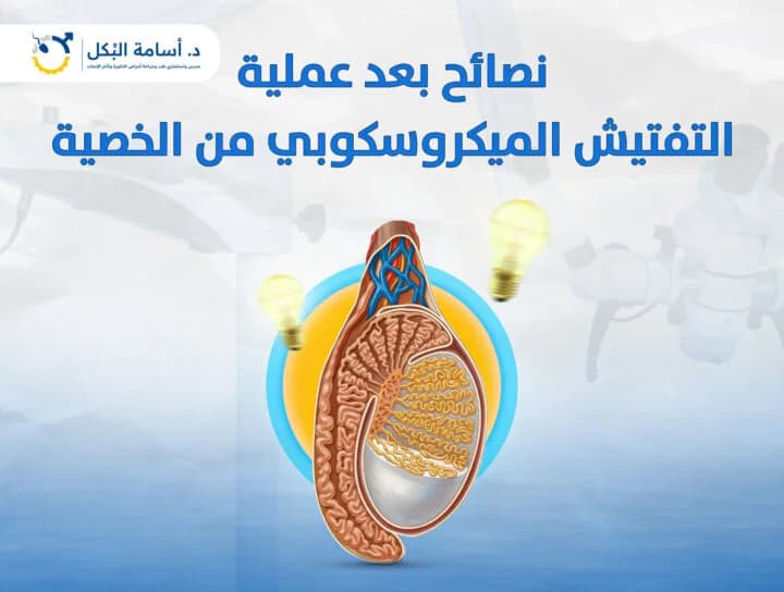 نصائح بعد عملية التفتيش الميكروسكوبي من الخصية
