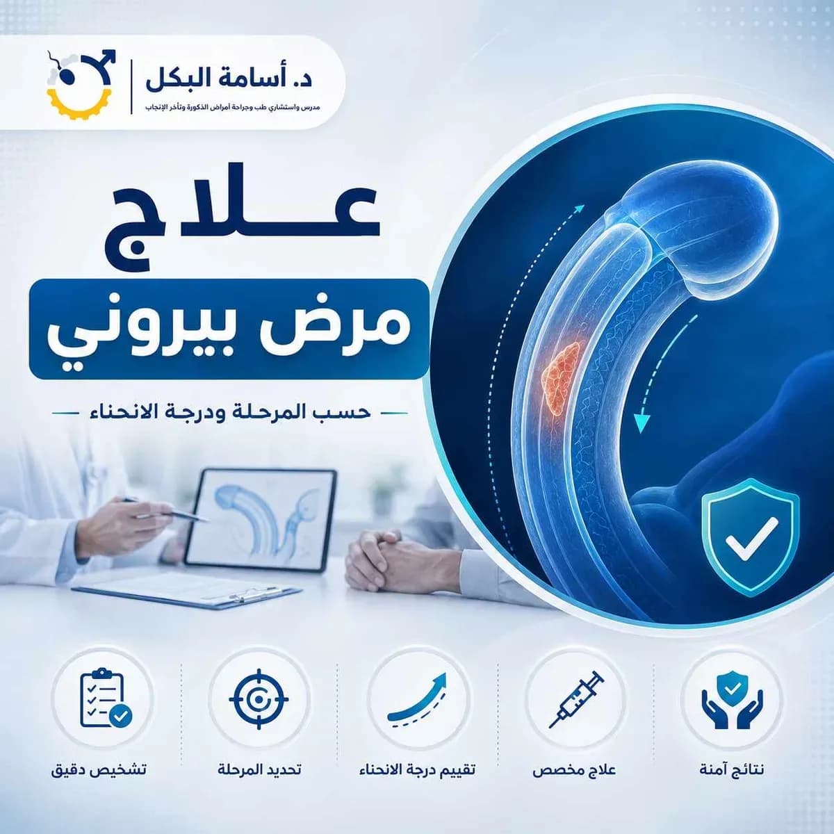 علاج مرض بيروني حسب المرحلة ودرجة الانحناء: دليل طبي شامل