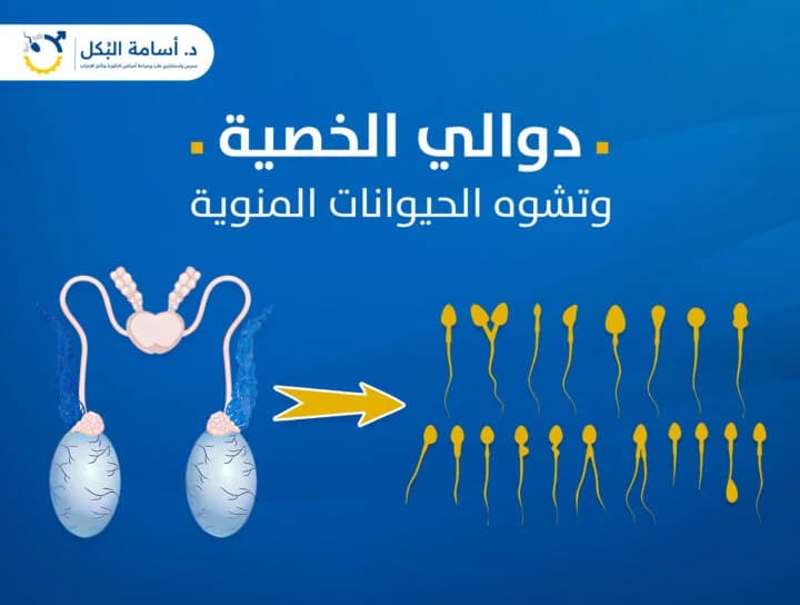 مشاكل الخصية