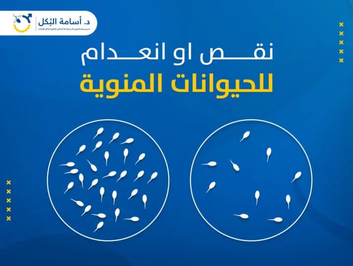 مشاكل الخصية