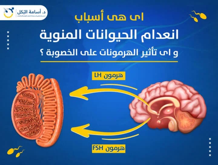مشاكل الخصية