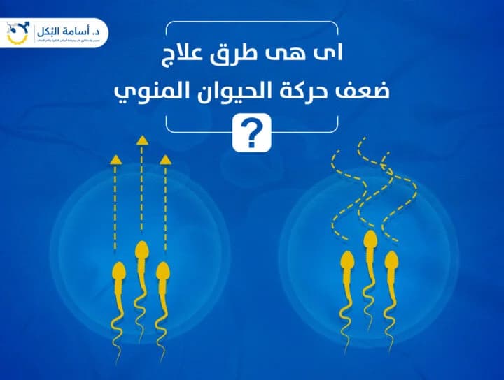 مشاكل الخصية