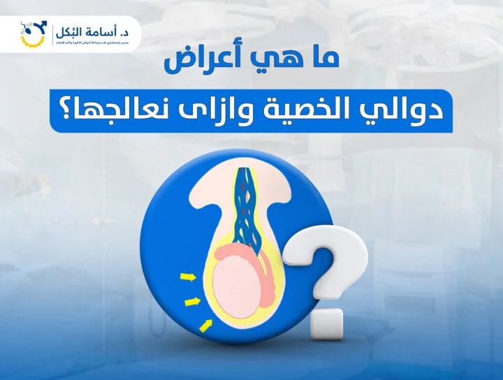 مشاكل الخصية