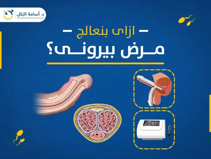 مشاكل الخصية