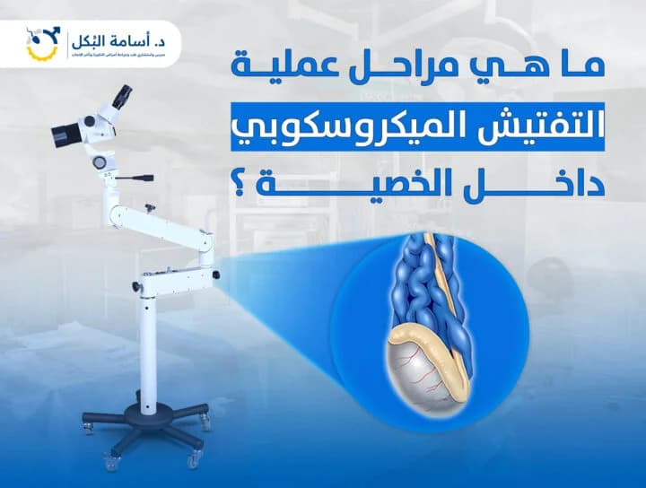 مشاكل الخصية