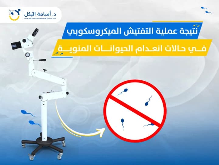 مشاكل الخصية