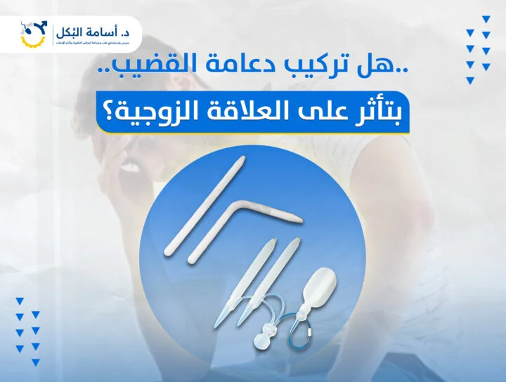 مشاكل الخصية