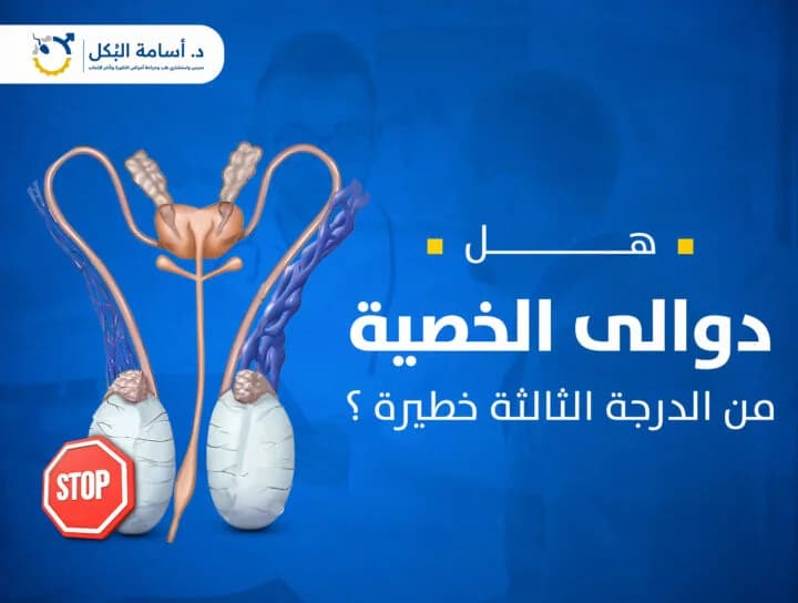 مشاكل الخصية