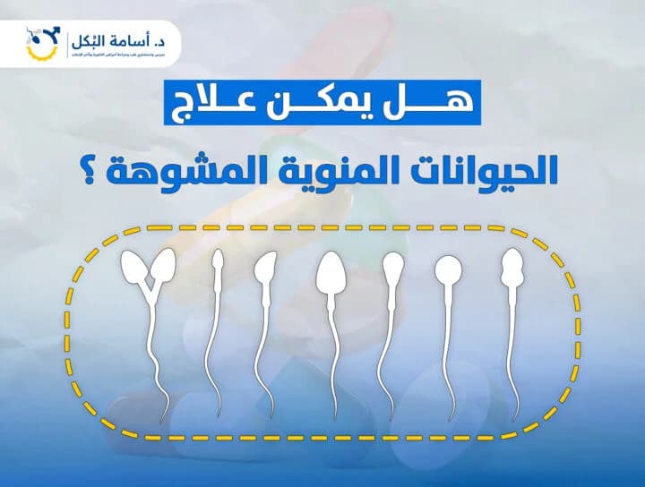 مشاكل الخصية