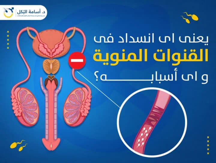 مشاكل الخصية