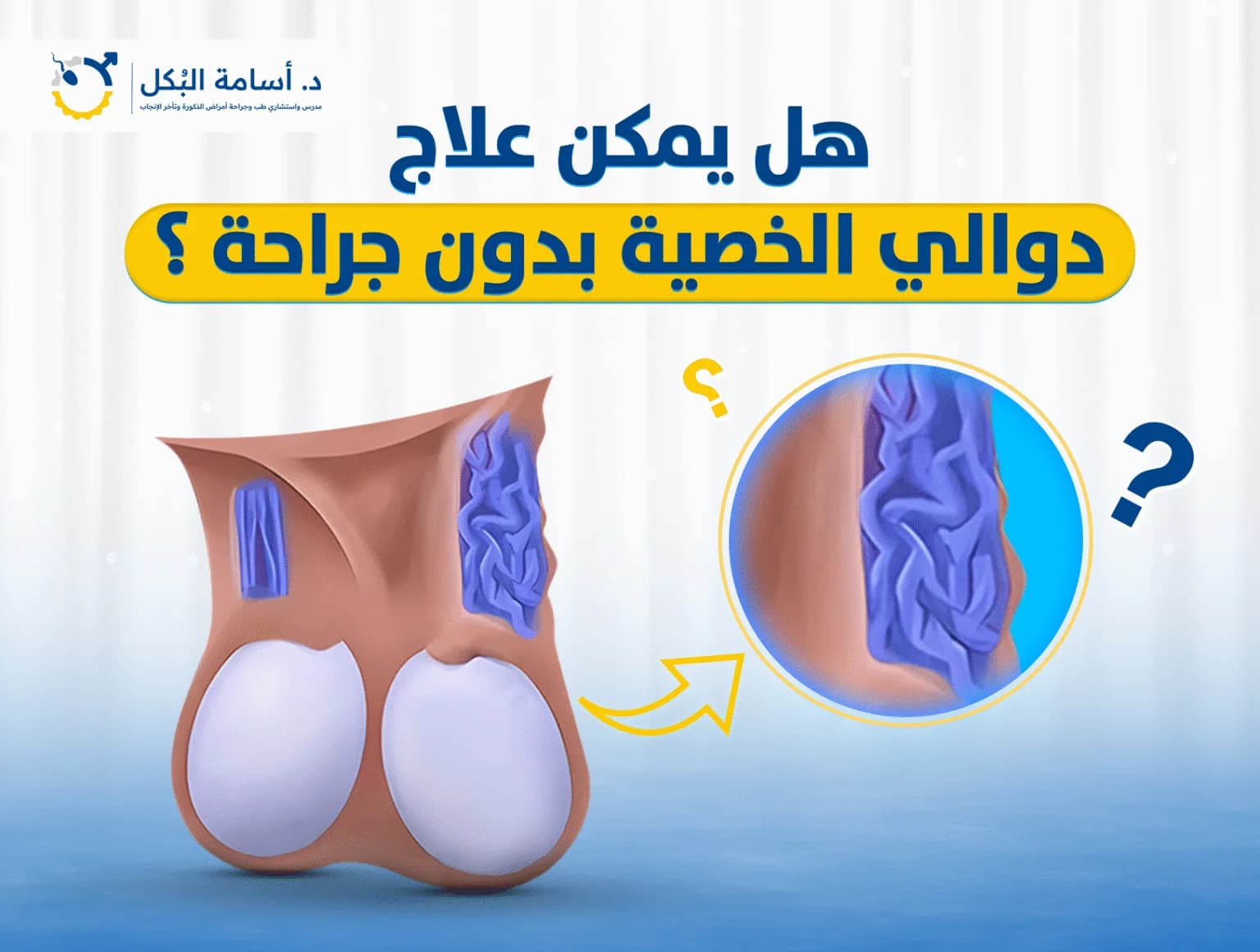 مشاكل الخصية