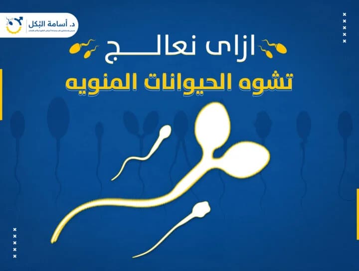 مشاكل الخصية