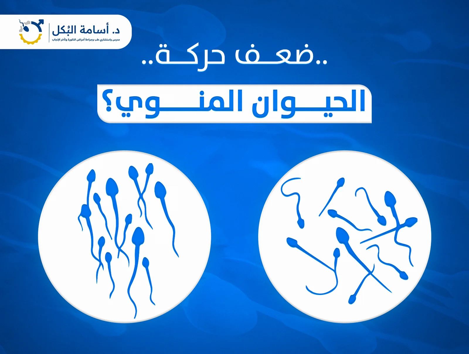 ضعف حركة الحيوانات المنوية