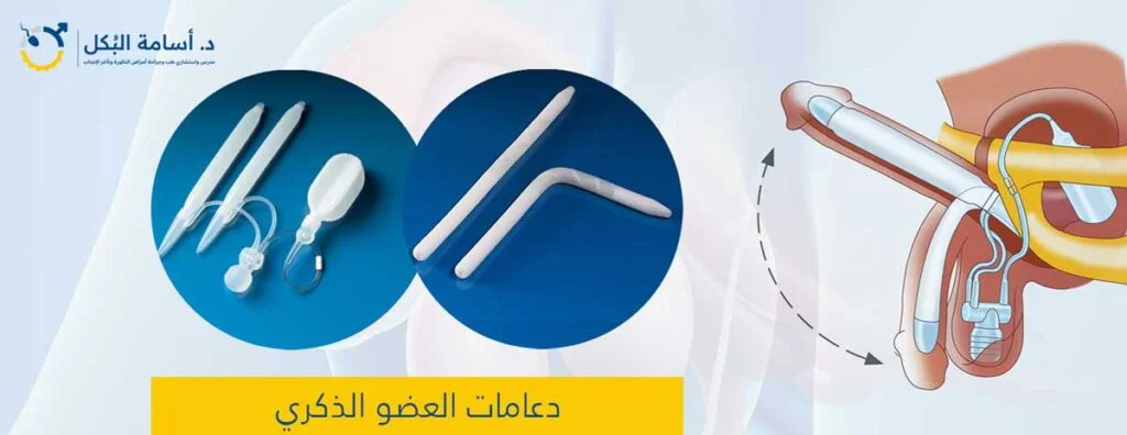 دعامات العضو الذكري