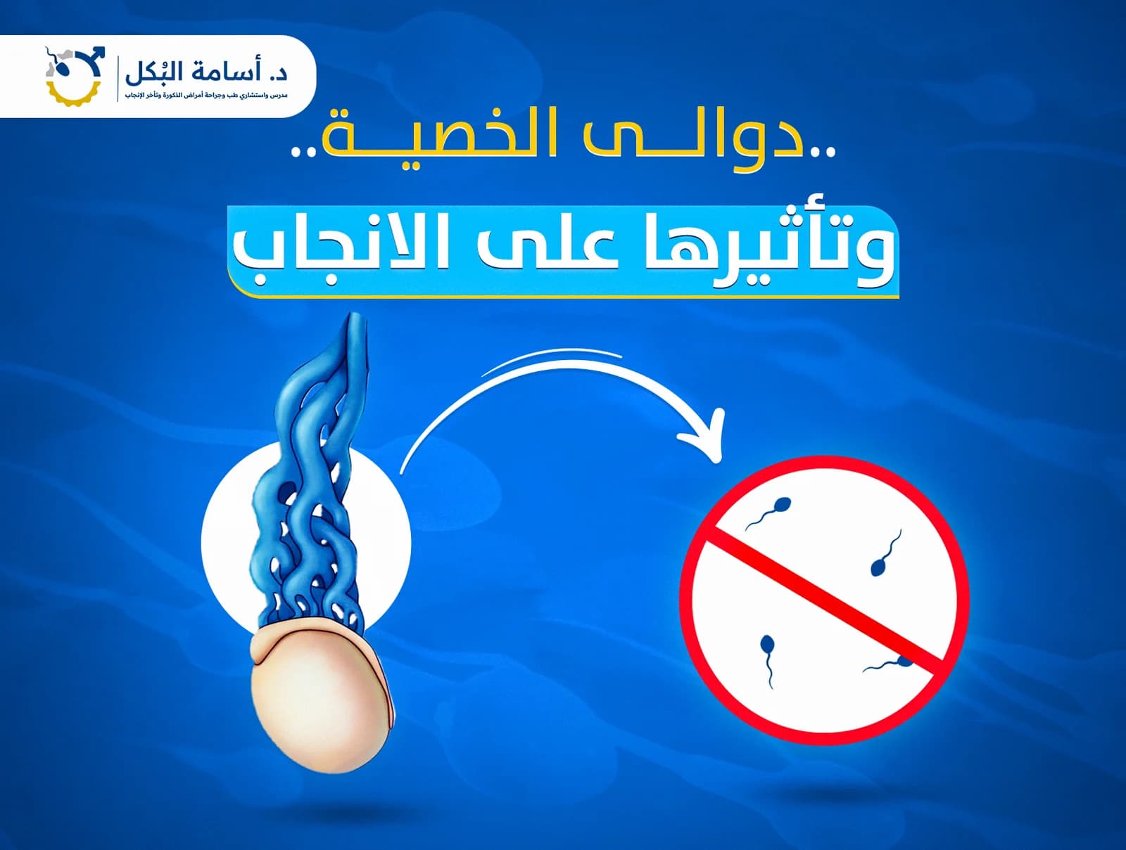 مشاكل الخصية