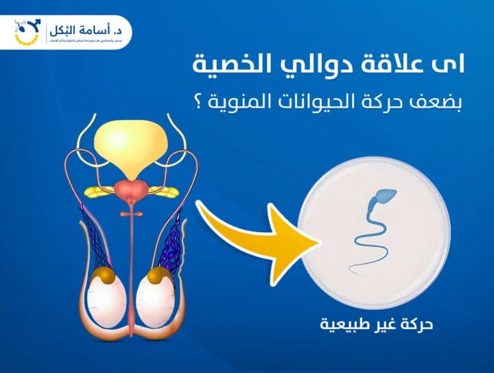 مشاكل الخصية