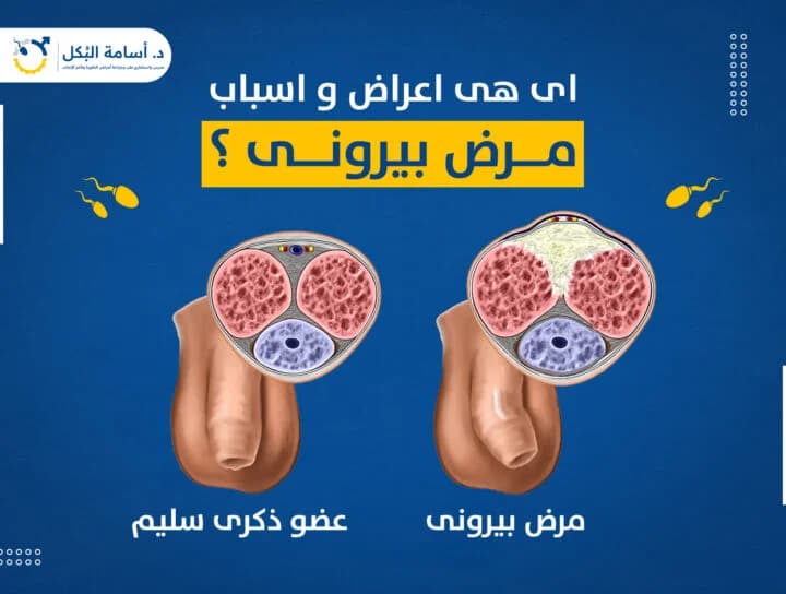 مشاكل الخصية