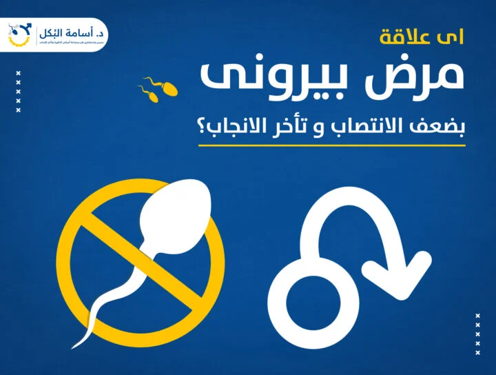 مشاكل الخصية