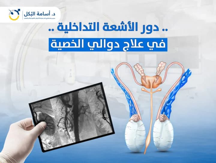 مشاكل الخصية