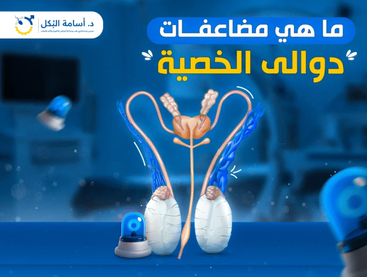 ما هي مضاعفات دوالي الخصية؟