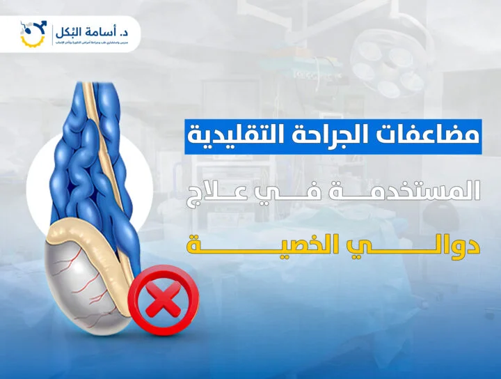مضاعفات الجراحة التقليدية المستخدمة في علاج دوالي الخصية