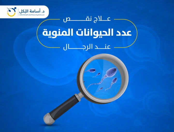 اى هى طرق علاج نقص عدد الحيوانات المنوية ؟