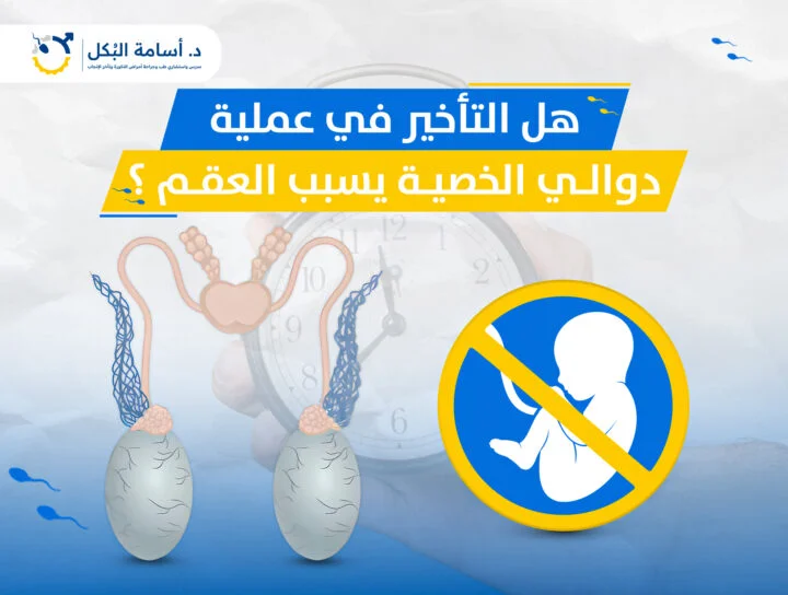 هل التأخير في عملية دوالي الخصية يسبب العقم ؟