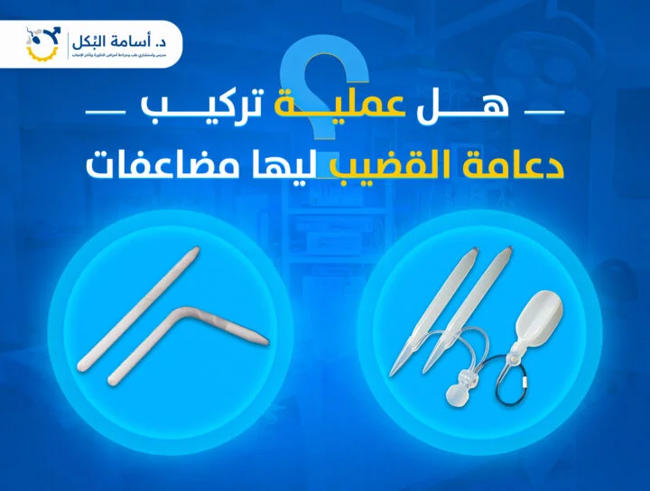 هل عملية تركيب دعامة القضيب ليها مضاعفات؟