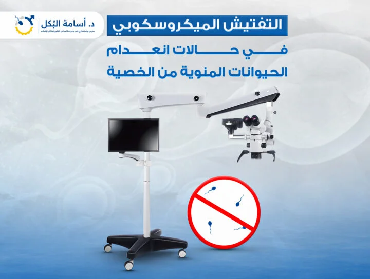 التفتيش الميكروسكوبي في حالات انعدام الحيوانات المنوية من الخصية
