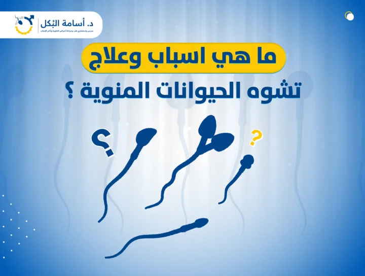 ما هي أسباب وعلاج تشوه الحيوانات المنوية؟