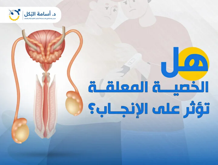 هل الخصية المعلقة تؤثر على الإنجاب؟