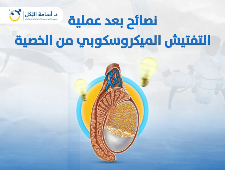 نصائح بعد عملية التفتيش الميكروسكوبي من الخصية