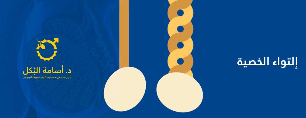 Testicular-Torsion, التواء الخصية, التواء كيس الصفن, إلتواء الخصية