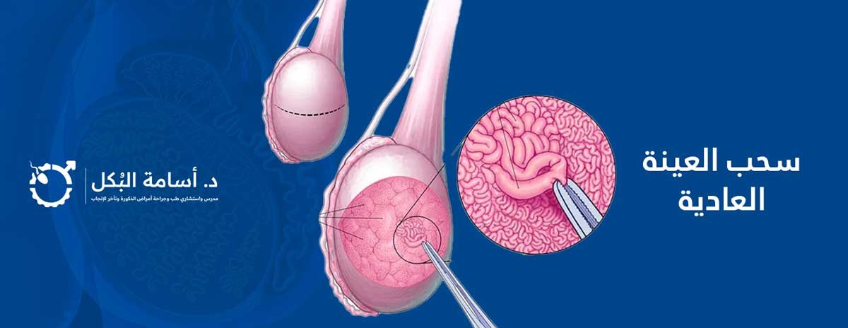سحب-العينة-العادية testicular-samples, عينات الخصية العادية
