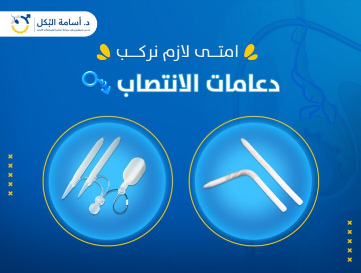 هل دعامة العضو الذكري بتعالج ضعف الانتصاب ؟