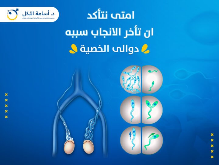 امتي نتاكد ان تاخر الانجاب سببه دوالي الخصية