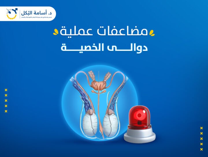 مضاعفات عملية دوالي الخصية