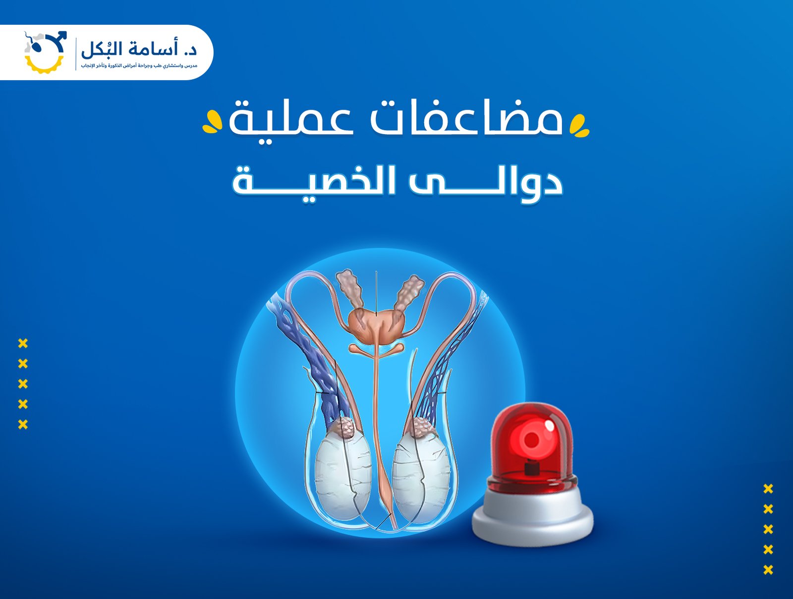 مضاعفات عملية دوالي الخصية