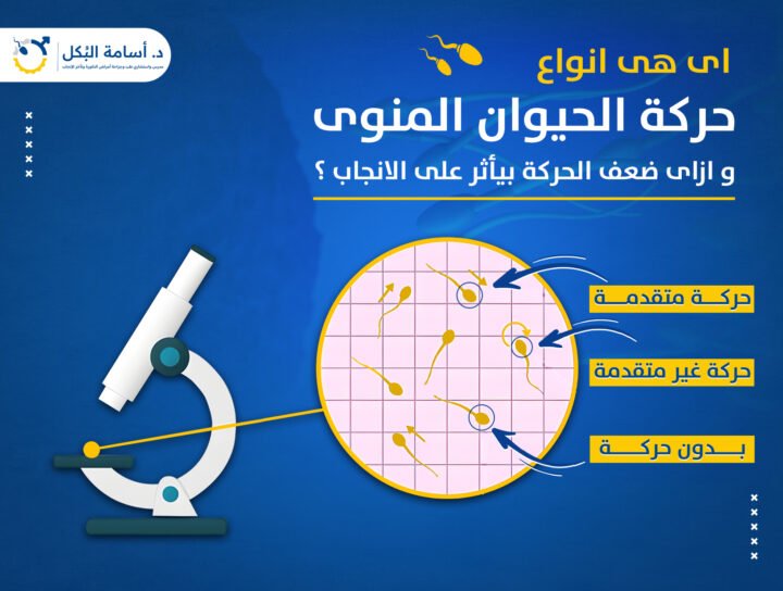 ايه هي انواع حركة الحيوان المنوي ، وازاي ضعف الحركة بياثر على الإنجاب ؟