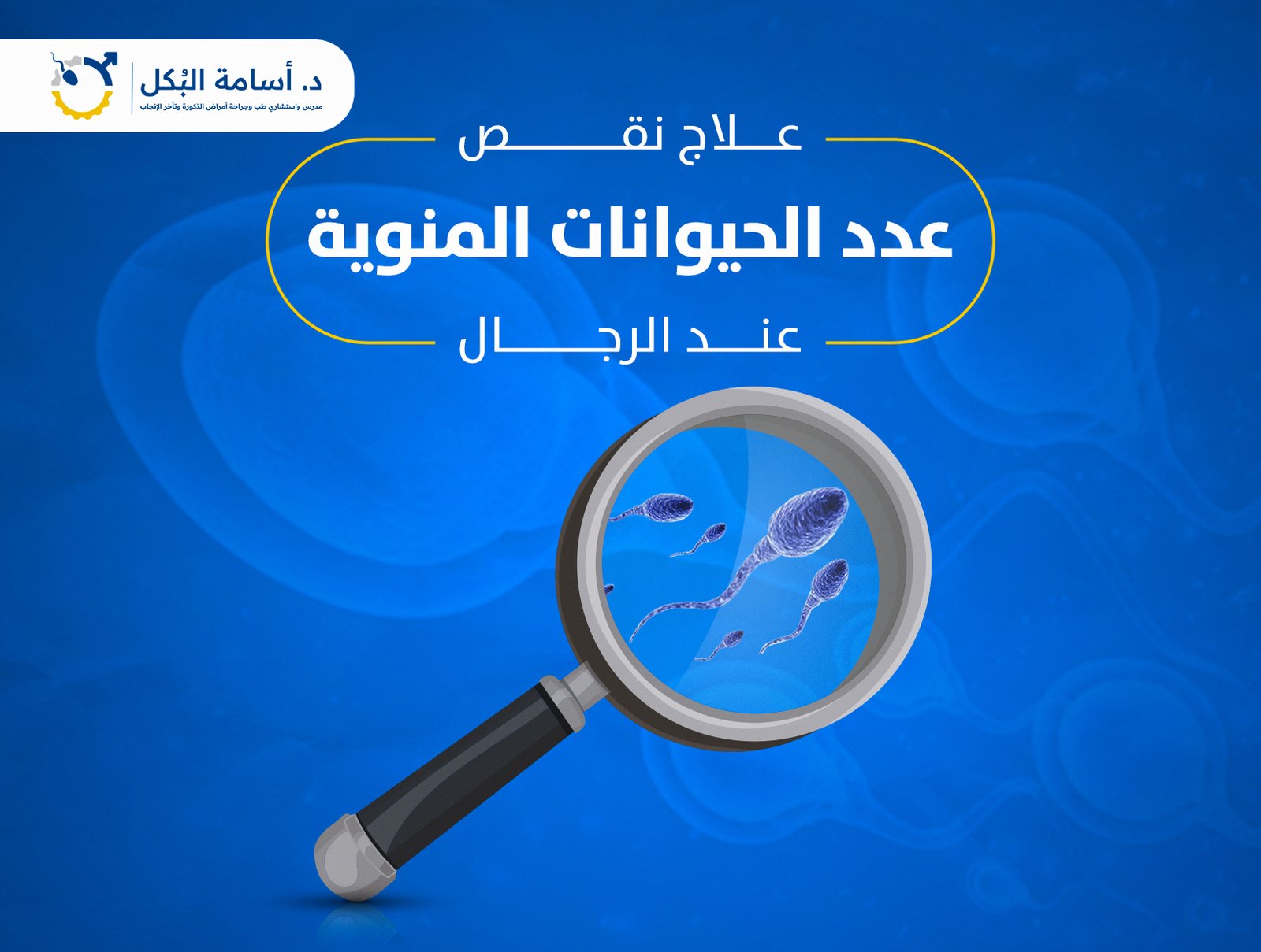 اى هى طرق علاج نقص عدد الحيوانات المنوية وازاى بنشخصه ؟