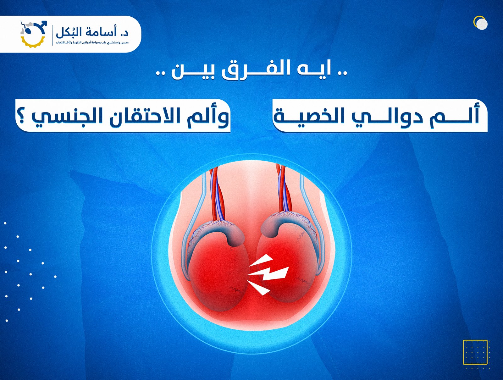 ايه الفرق بين الم دوالي الخصية وألم الاحتقان الجنسي ؟