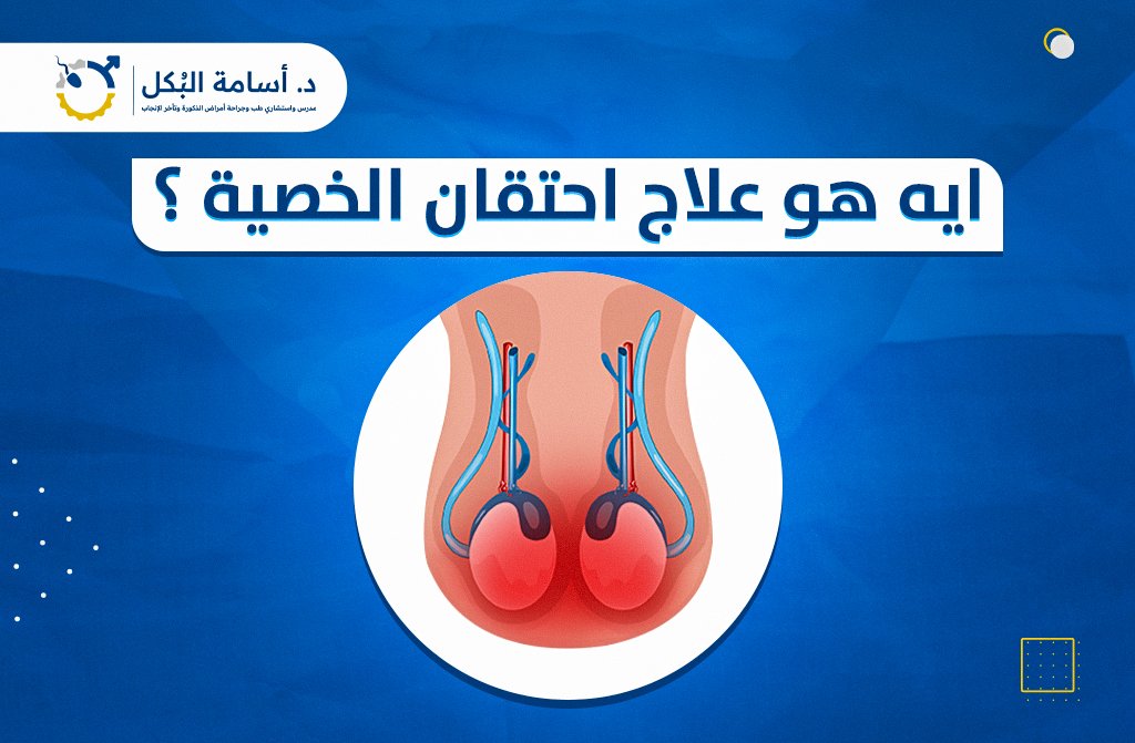 ايه هو علاج احتقان الخصية ؟