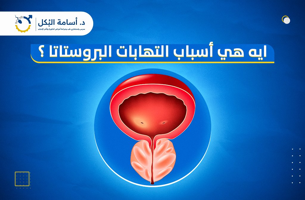 اي هي اسباب التهابات البروستاتا ؟