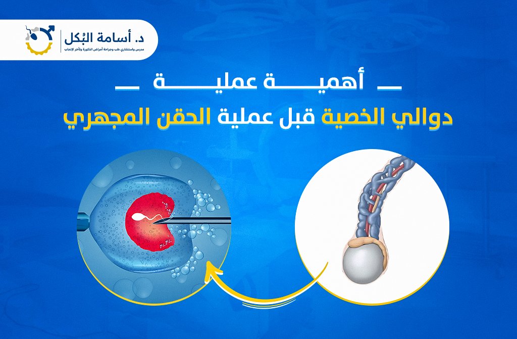 أهمية عملية دوالي الخصية قبل عملية الحقن المجهري