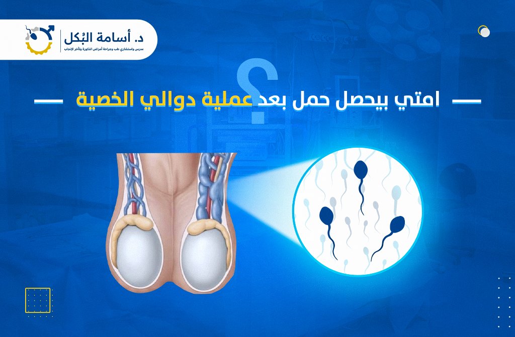امتي بيحصل حمل بعد عملية دوالي الخصية