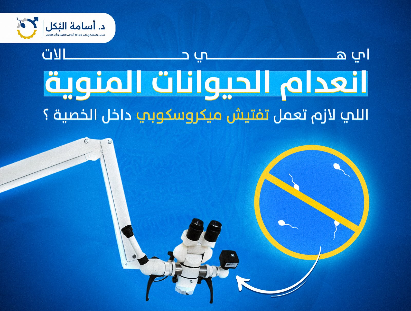ايه هي حالات انعدام الحيوانات المنوية اللي لازم تعمل تفتيش ميكروسكوبي داخل الخصية