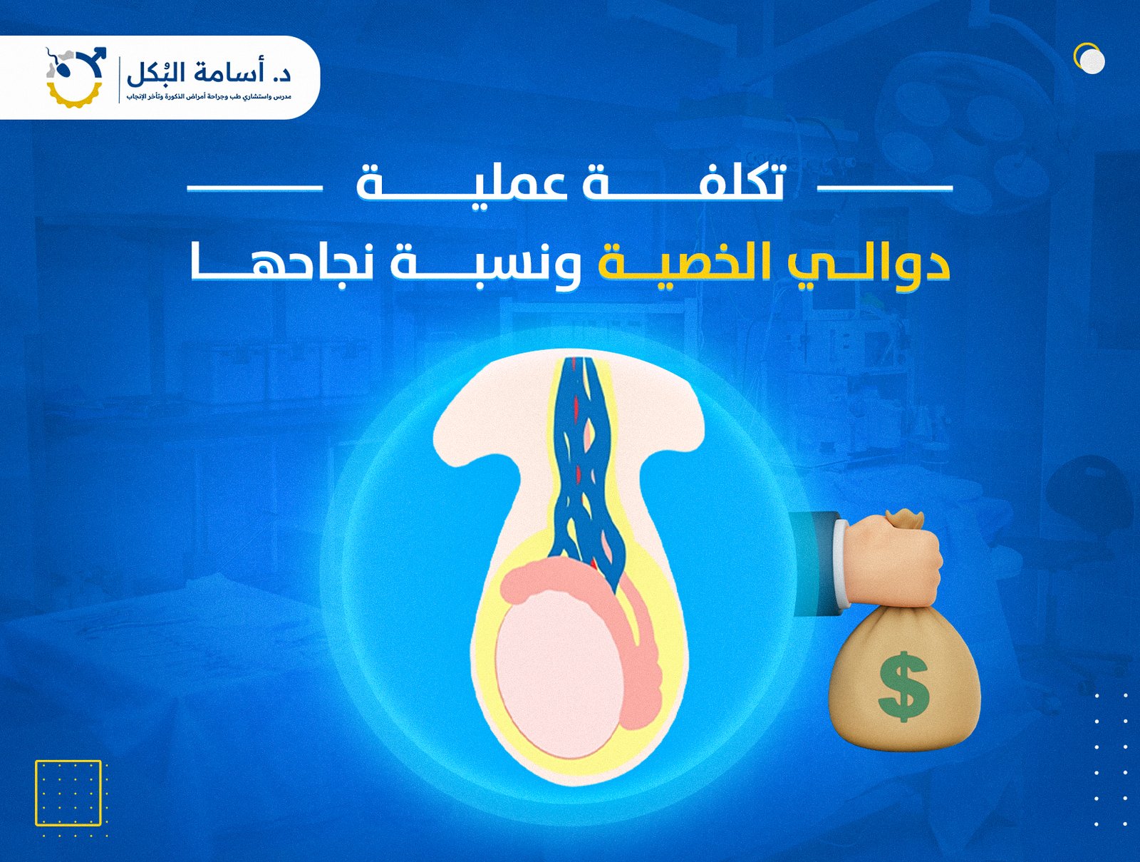 تكلفة عملية دوالي الخصية ونسبة نجاحها