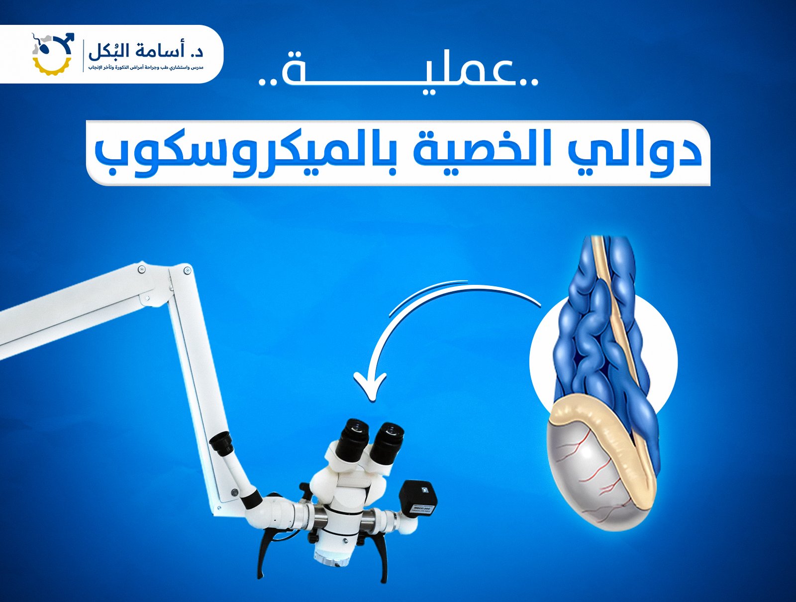 عملية دوالي الخصية بالميكروسكوب