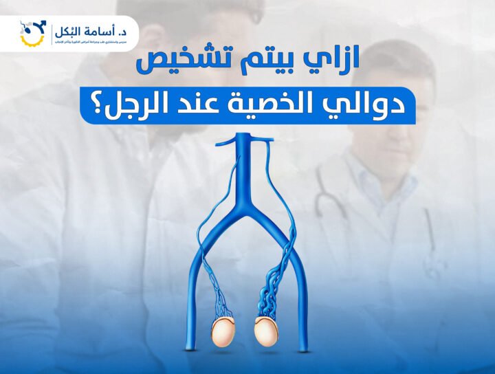 ازاي بيتم تشخيص دوالي الخصية عند الرجل؟