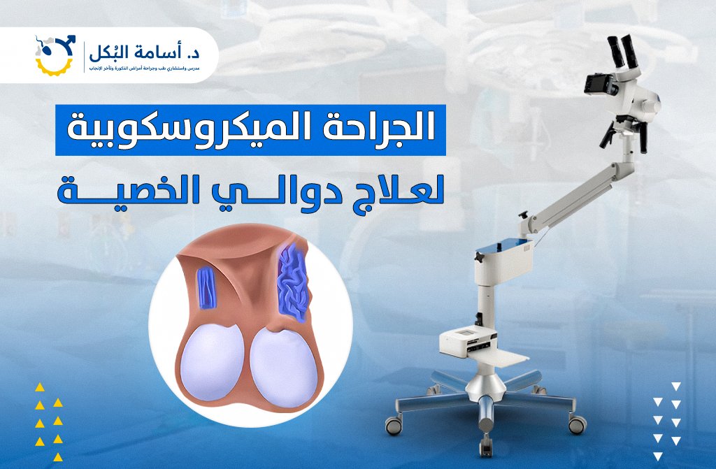 الجراحة الميكروسكوبية لعلاج دوالي الخصية